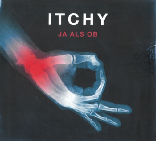 Itchy mit dem Album Ja als ob